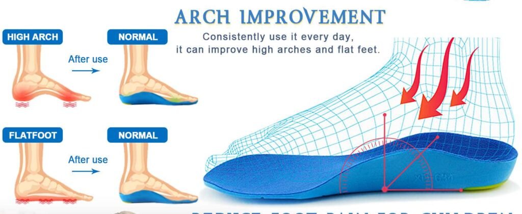 Kids PU Foam Insoles with Arch Support – Plantar Fasciitis Inserts for Flat Feet (1)