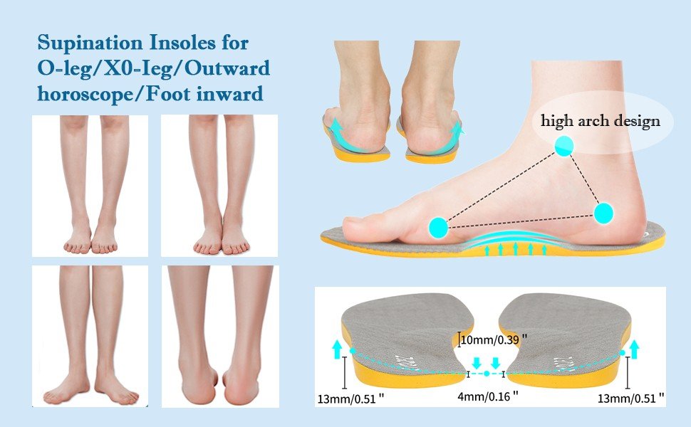 Orthopedic Supination Insoles – Premium Support for Foot Health